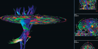 BrainMapping_760x427